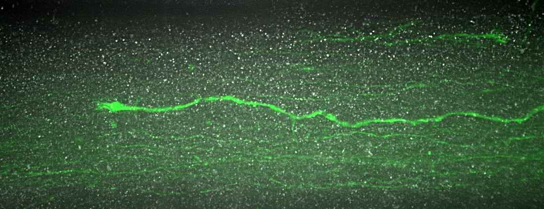OB_Axon