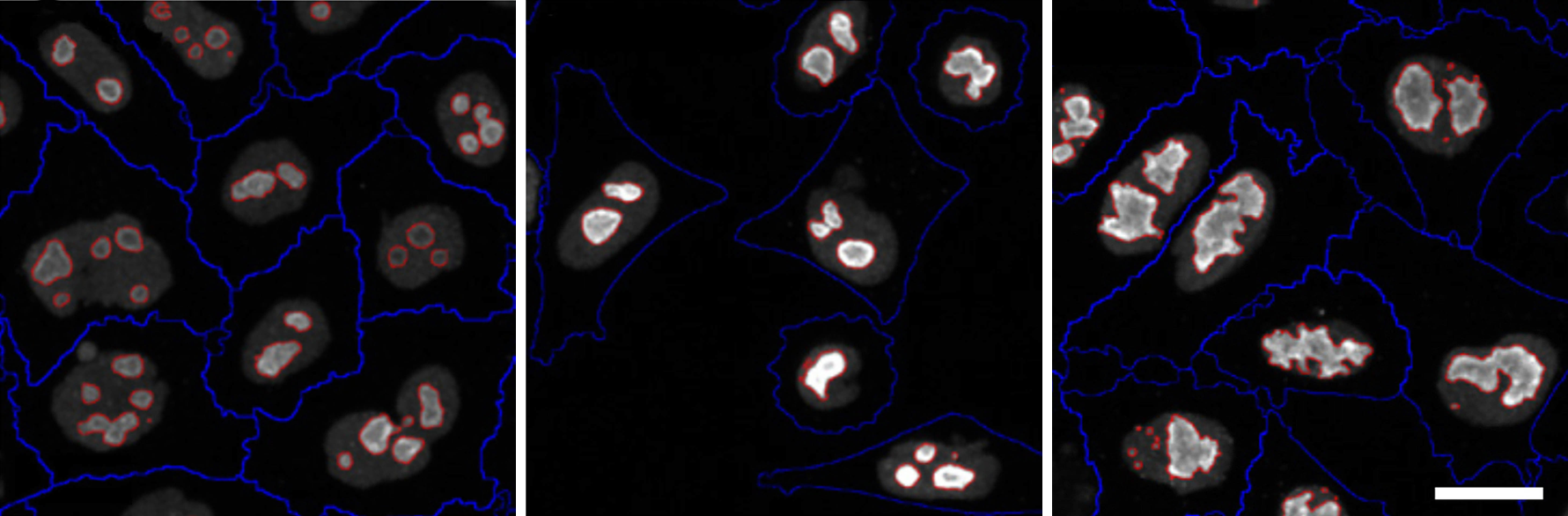 Image-based screen of nucleoli