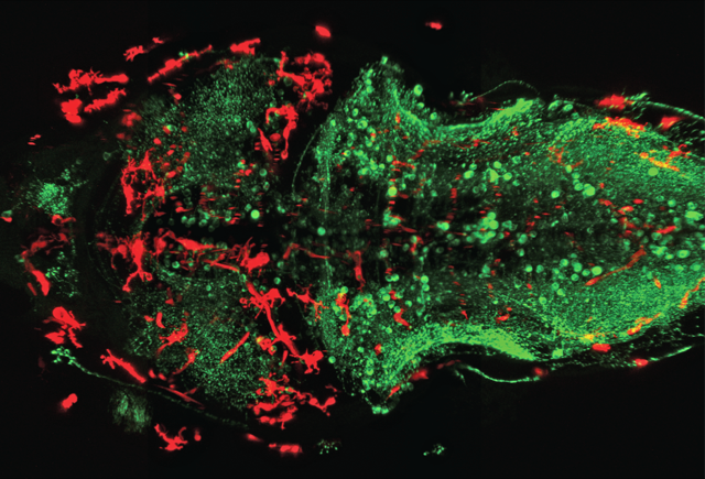 Microglia