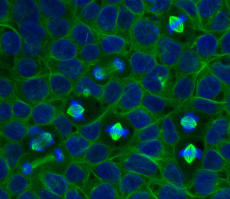 cells in mitosis